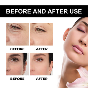 Vitamin C Serum For Face Dark Spot Removal Niacinamide Moisturizing Brightning Shrink Pores Essence Beauty Firming Skincare 109g